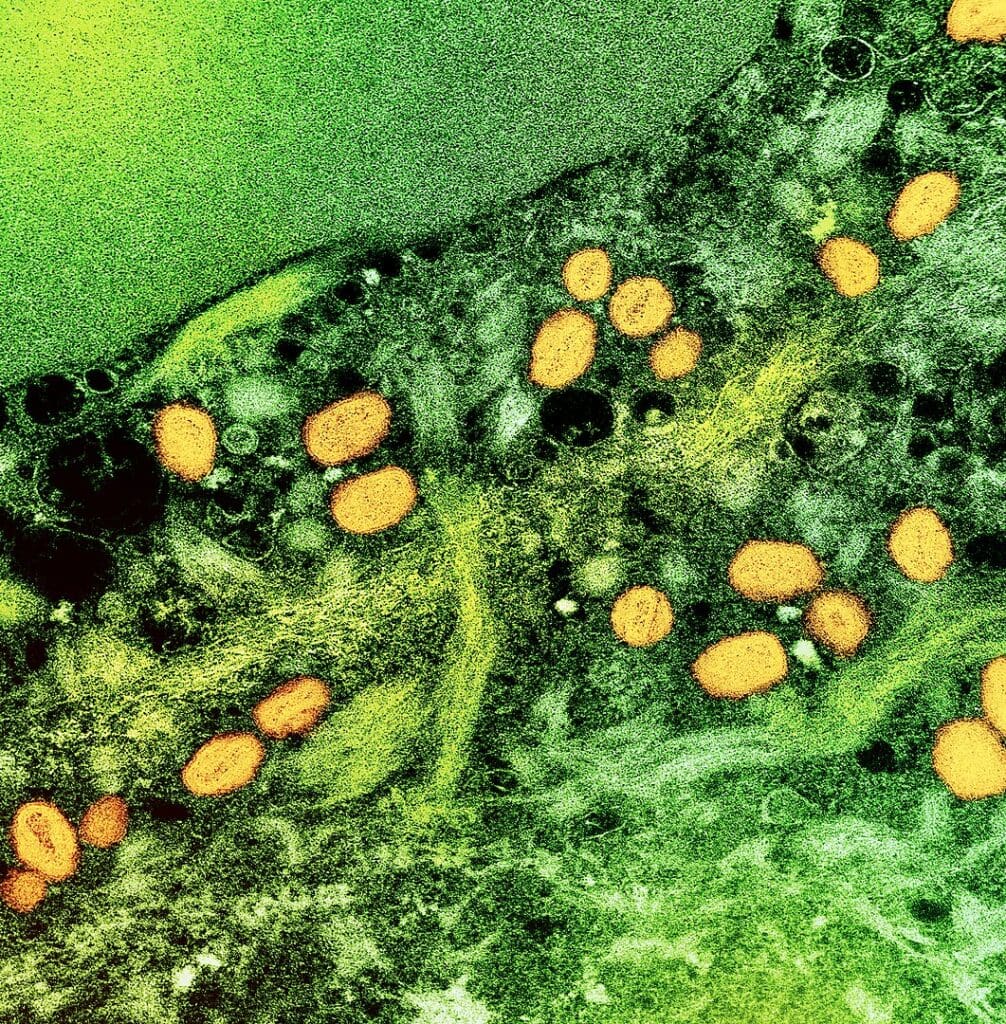 Colorized transmission electron micrograph of monkeypox particles (yellow) found within an infected cell (green), cultured in the laboratory.