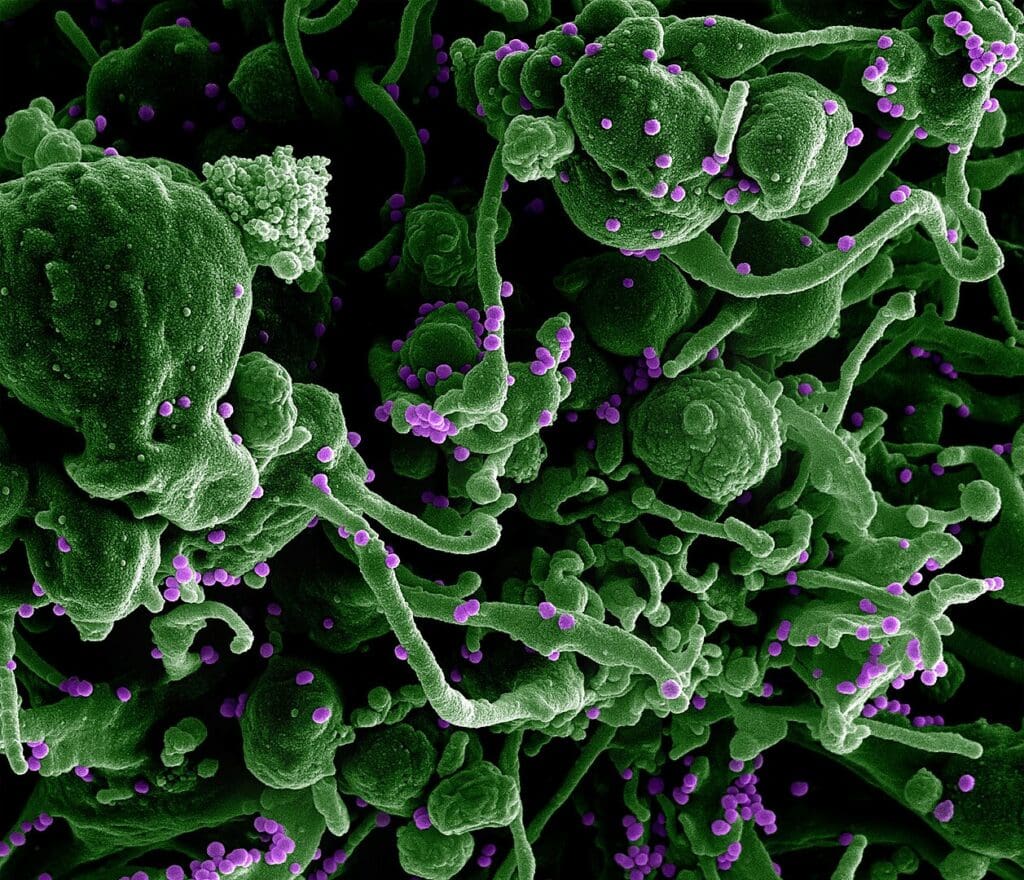 Scanning electron micrograph of Lassa virus budding off a cell.